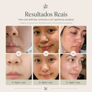 AGE-R Booster Pro – Dispositivo Facial 6 em 1 para Rotina Avançada de Skincare